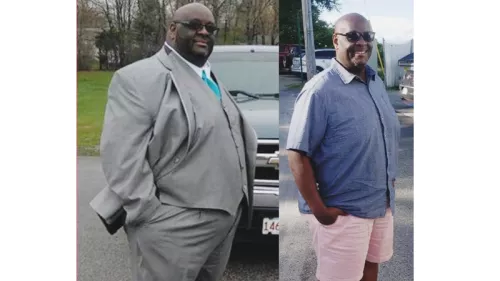 Ollie Spears before and after weight loss surgery